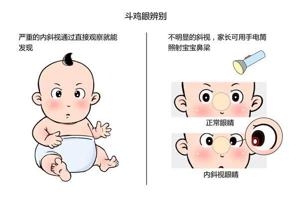 如果是6个月以内的宝宝,一般不给予干预;如果6个月以后仍然是斗鸡眼