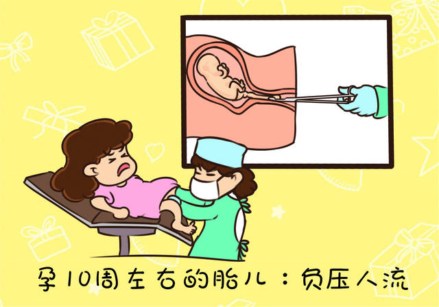 3,孕10-14周的胎儿:器械"分解"取出