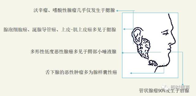 涎腺肿瘤年龄特点