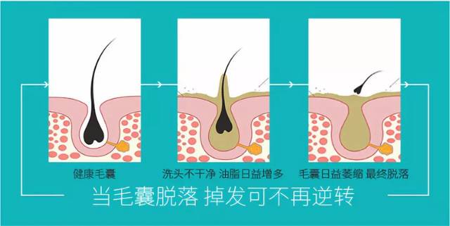 深层清洁 按摩头皮,毛囊健康,头发才能健康