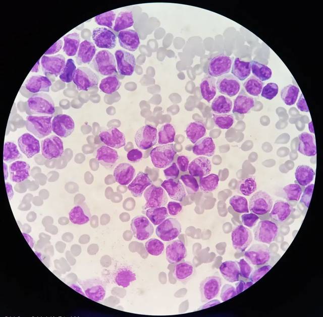 红细胞,白细胞,血小板,这些数值看得我头晕.