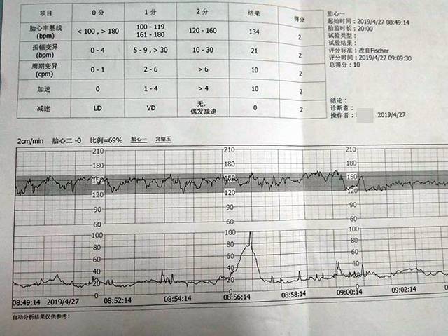 "孕39周,我的宝宝缺氧了……"关于胎监,这些你要懂