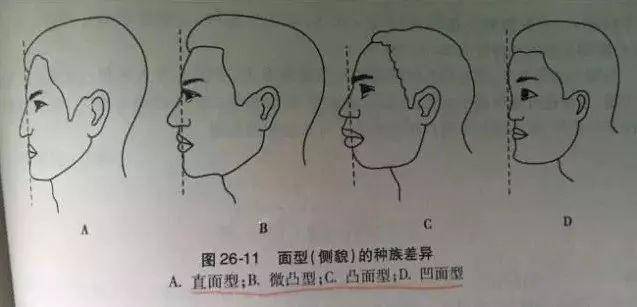 然后 再延伸一下,还可以划分出一个微凸面型——即鼻下点在眉间点与颏