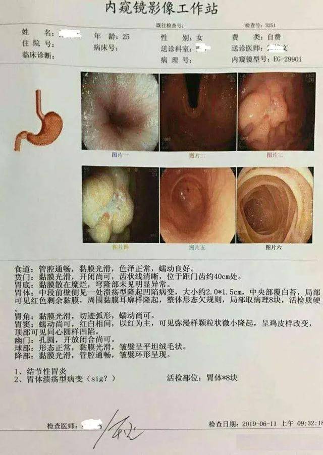 3分钟看懂胃镜活检病理报告,医生一般不会跟你
