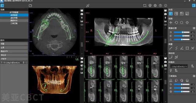高可靠,更"聪明"的口腔cbct来了!
