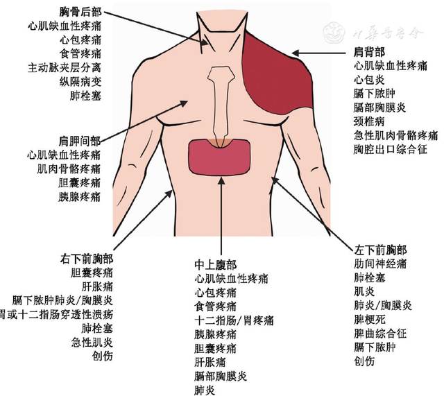 常见胸痛部位和病因