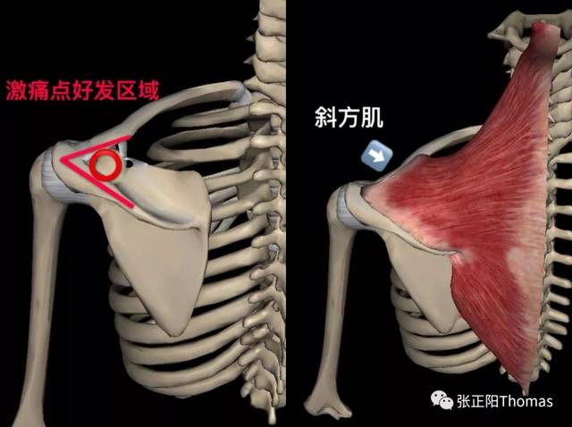 因为还得松解她局部强烈的潜在激痛点(左侧的枕后肌群,尤其是头上斜肌