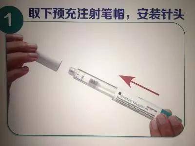 同济医院"试管婴儿"圆梦之旅(四):打夜针环节