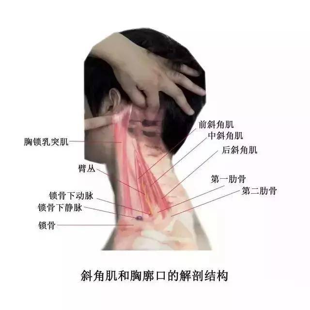 起点:颈阔肌下缘起自胸大肌和三角肌筋膜,肌纤维斜向上内方,越过锁骨