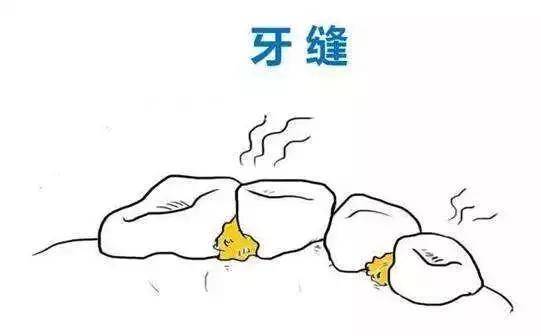 这些可恶的牙菌斑不断危害牙组织,可以潜伏长达10-20年,等发展到重度