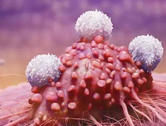 癌症都是"吃"出来的,4种食物少碰,多吃一口,就在喂养癌细胞