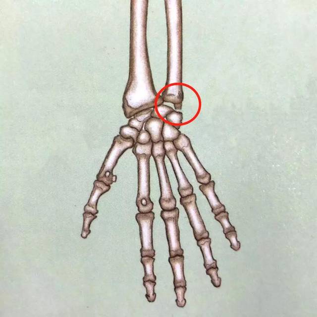 『手腕疼』就是腱鞘炎?当心"尺骨撞击综合征"