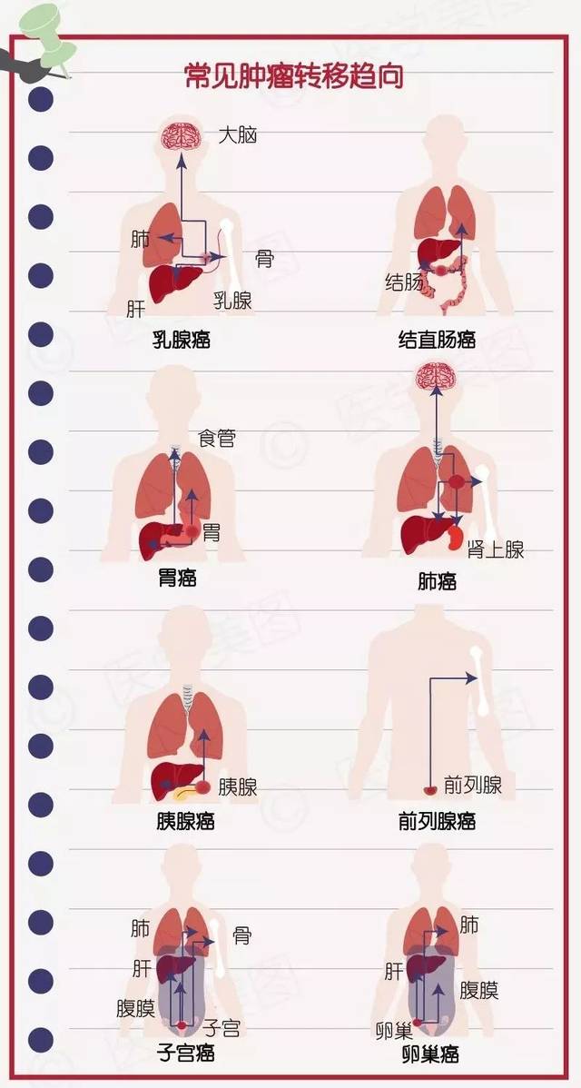 肿瘤容易转移的部位通常来源于这些原发灶