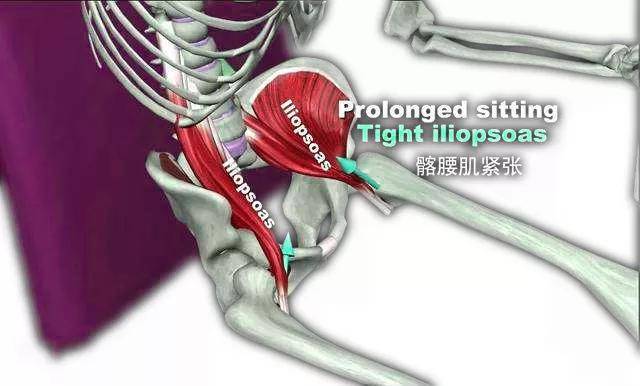 熟悉又陌生的髂腰肌千万不要忽视
