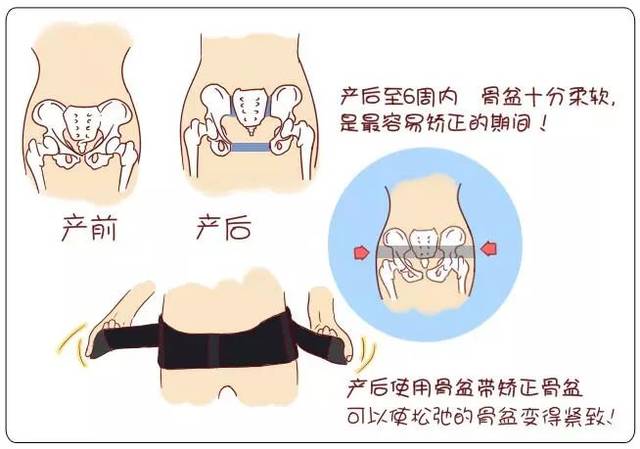 ④体检时耻骨联合处按压时痛感明显,骨盆挤压—分离试验阳性,可触到