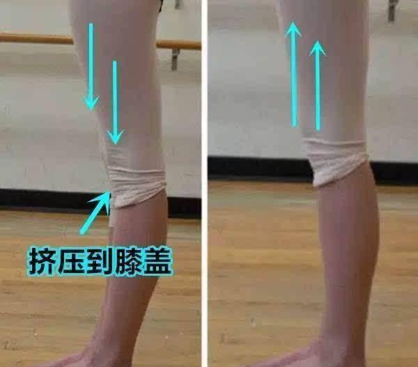 原创改善"膝超伸",保护膝关节!