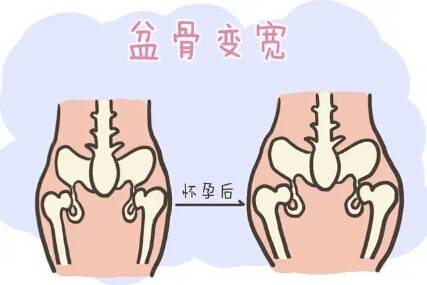 深度解析徒手盆骨恢复原理,告诉你产后恢复徒手修复是否有效