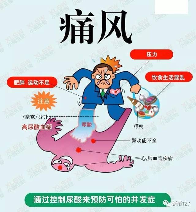 国医大师王琦是如何运用四妙勇安汤治疗痛风的?