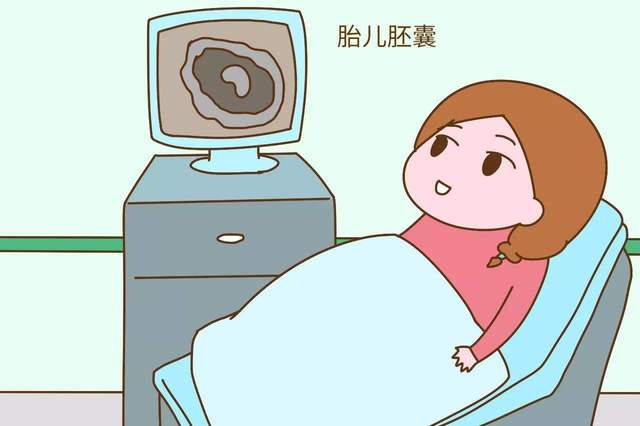 nt检查,超声检查,四维检查需要空腹么,有哪些需要注意