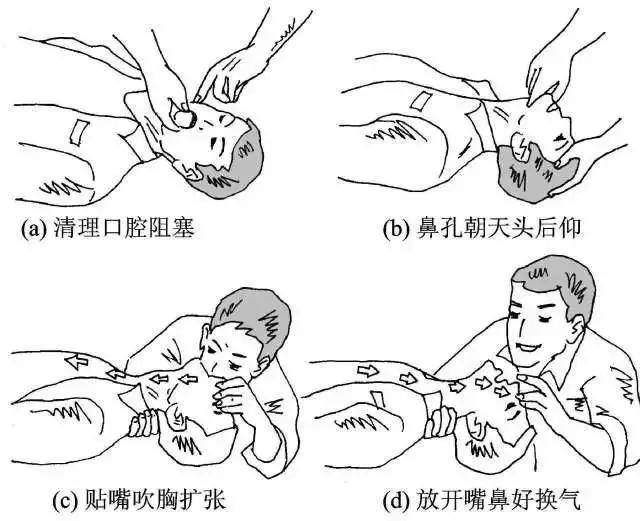 还可以配合 人工呼吸