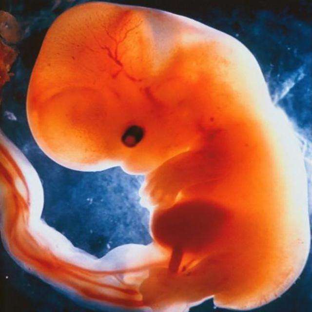 原创怀孕5-9周,"胚胎"分化成"胎儿",生命就是这么神奇!附注意点