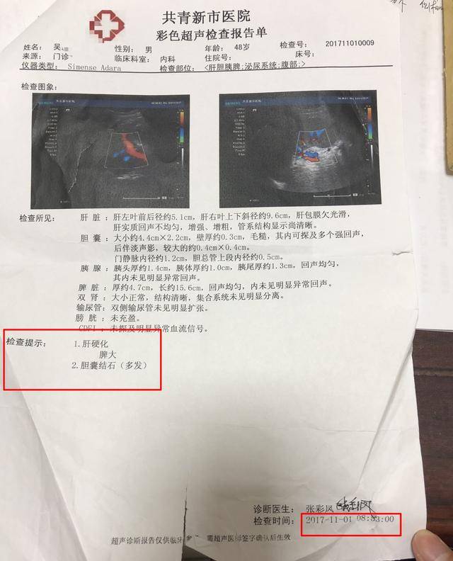 继续治疗, 2017年11月1日共青新市医院彩超显示: 肝硬化,脾大,胆囊