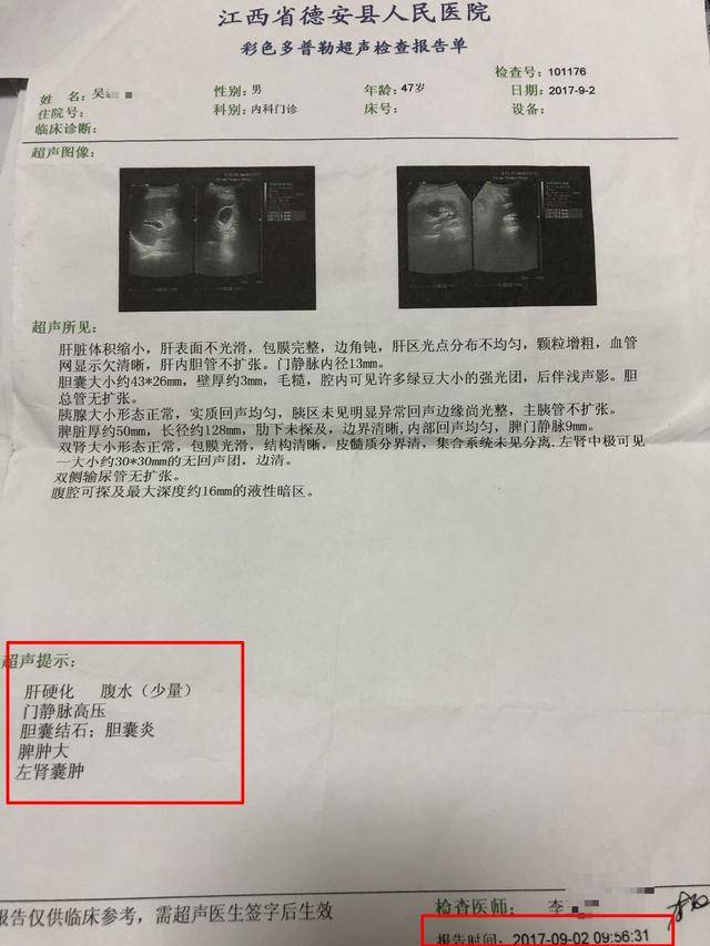 继续治疗, 2017年11月1日共青新市医院彩超显示: 肝硬化,脾大,胆囊
