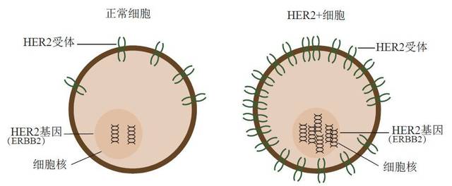 【学术交流】什么是HER2阳性乳腺癌的双靶向