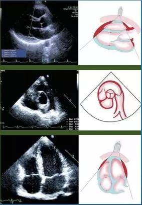 超声心动图十大基本功3.1:心内科医生为什么要掌握心脏超声知识