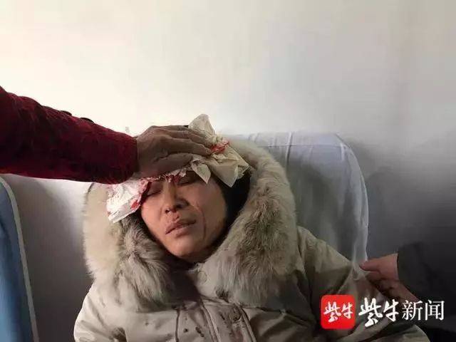 头被砸出血,女教师依然用尽全力托住1米8高路牌:因为身后有一群孩子