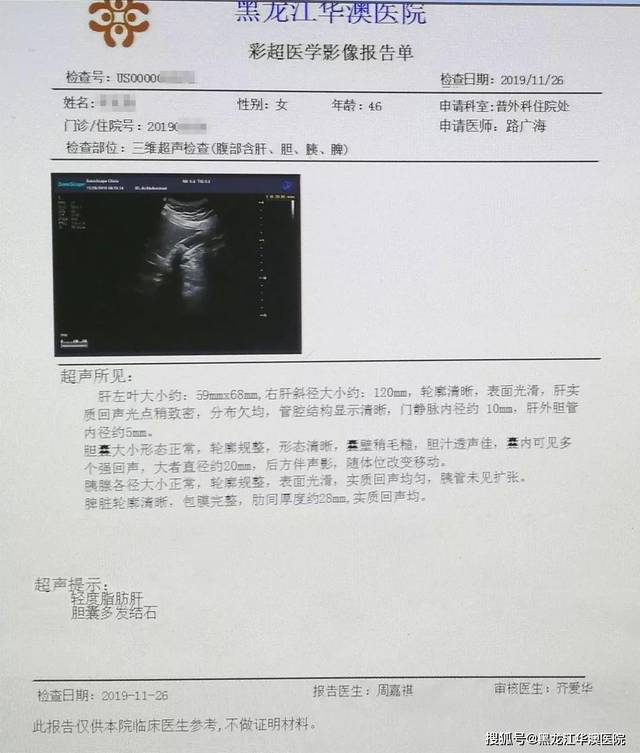 双镜联合保胆取石术 巧去胆结石