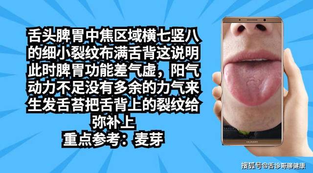 抖音舌诊哥舌象分析与感悟:胃肠疾病,气短,虚汗,恐惧不安