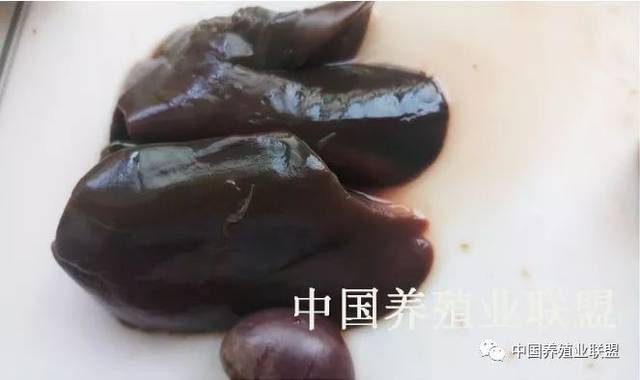 脾脏显著肿大