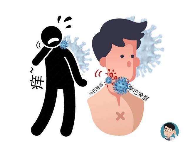 无论男女,脖子一旦出现这种现象,暗示有艾滋病?医生这次得解释