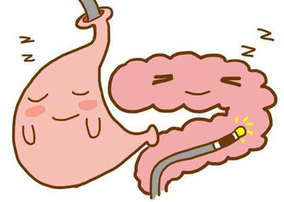 睡眠中进行的胃肠镜