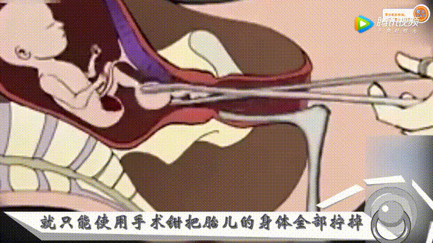 给你100万,你敢生三胎吗?_手机搜狐网