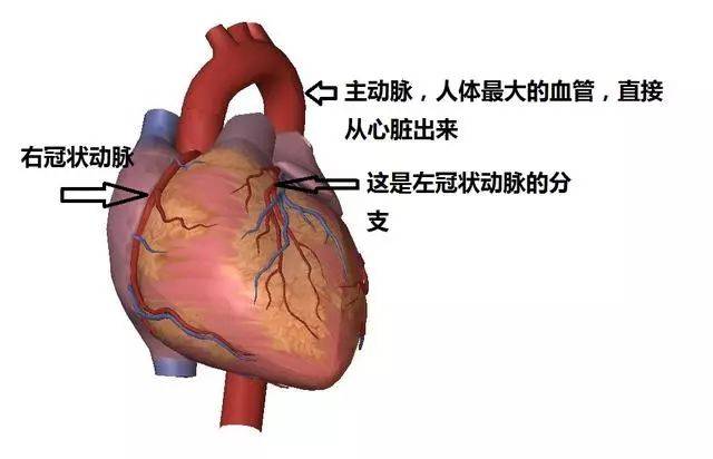 这些图帮你认清冠心病和冠状动脉拿走不谢