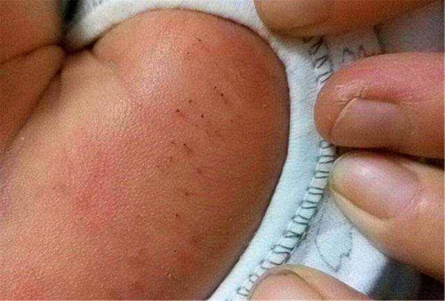 新生儿胎毛和胎脂的作用