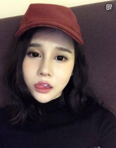 赵本山女儿的整形脸崩塌,20岁像40岁的大妈,越来越像刘梓晨