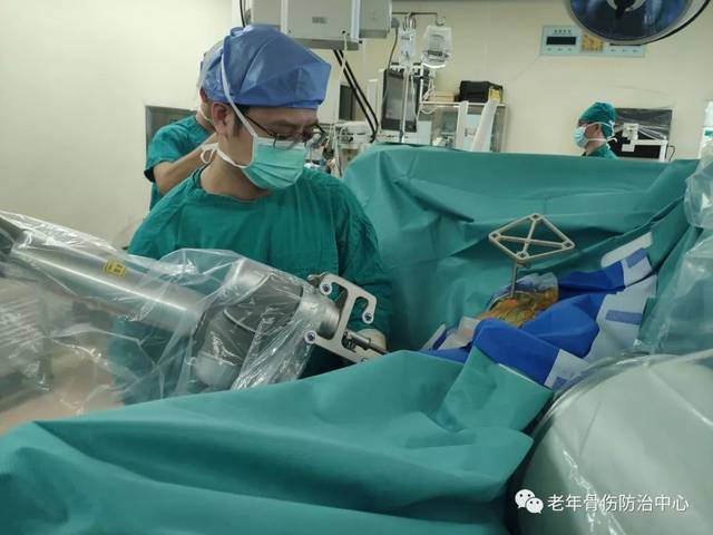 微新闻 | 华南地区首例fns系统保髋治疗股骨颈骨折