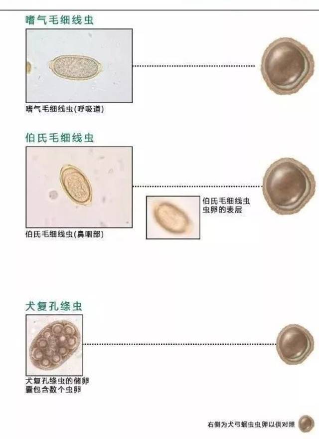 血液尿液粪便中常见寄生虫鉴别