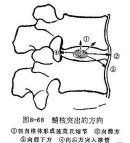 腰椎解剖图基础