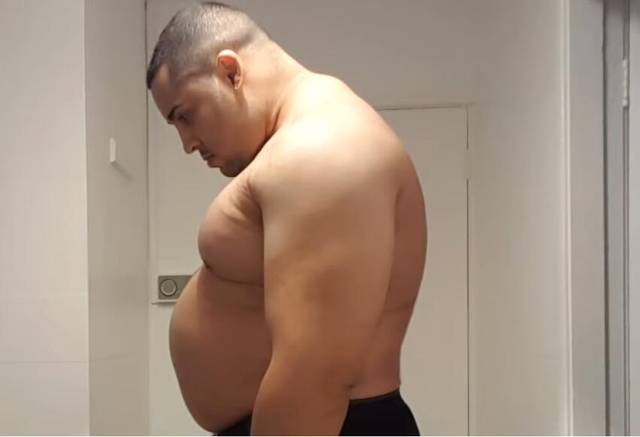 肉胖子转变肌肉男参加比赛,摄入类固醇18个月后,检测一切正常