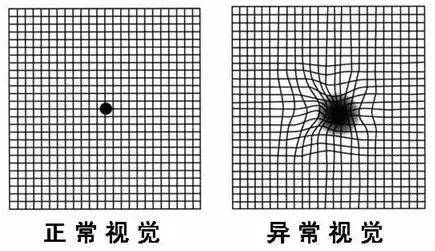 老花眼测试