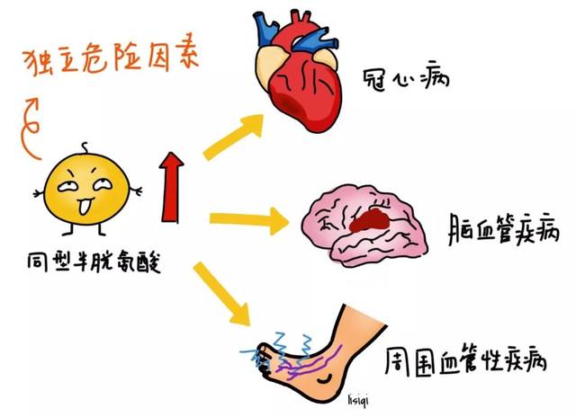 "三高"后的第四"高"---高同型半胱氨酸血症