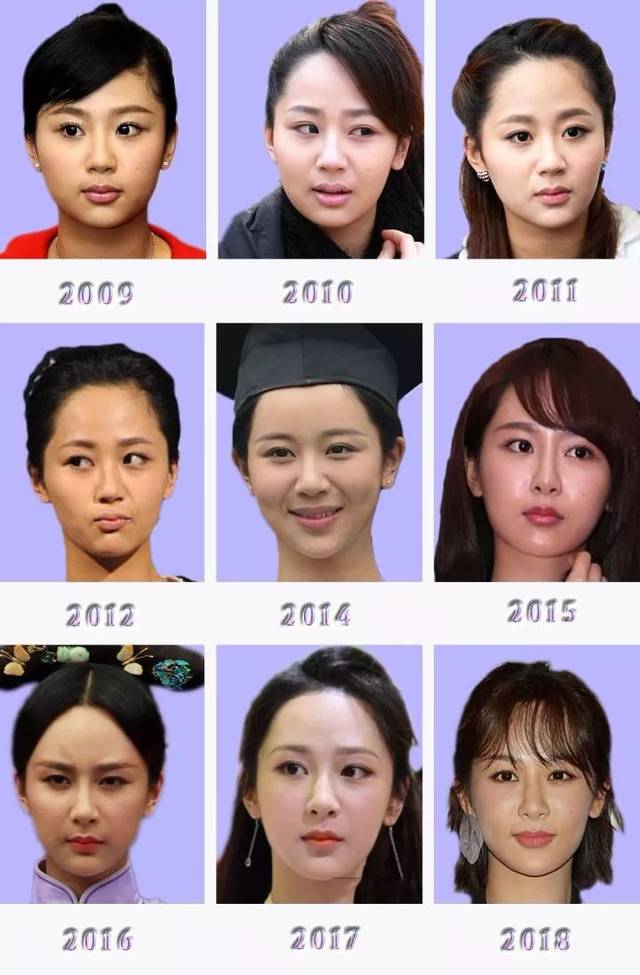 杨紫整容照被医院挂在宣传墙!成功案例值得大肆传播?小心律师函