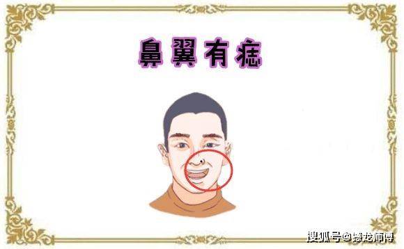 鼻翼有痣