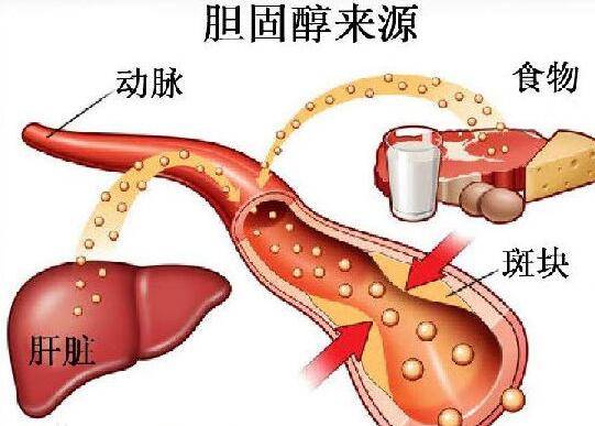 胆固醇高的原因和危害,胆固醇高建议吃这些!