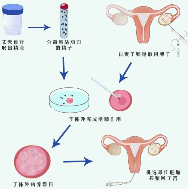 卵发育成6-8个卵裂球或者囊胚,移植回母体子宫内使之着床的完整过程