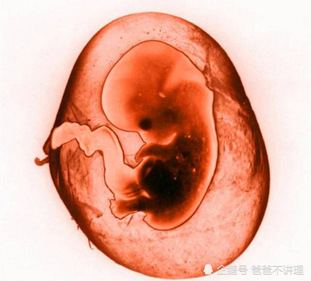 怀孕15周胎儿发育图,15周流产下来胎儿图片 怀孕16周胎儿发育什么样子,如果引产,胎儿还能存活下来吗?